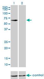 CBS Antibody in Western Blot (WB)