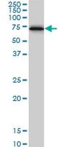 CBS Antibody in Western Blot (WB)