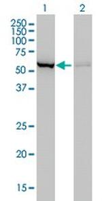 CBS Antibody in Western Blot (WB)