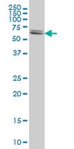 CBS Antibody in Western Blot (WB)