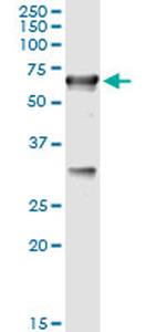CBS Antibody in Immunoprecipitation (IP)