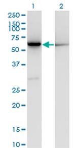 CBS Antibody in Western Blot (WB)