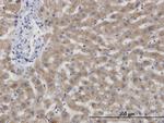 CBS Monoclonal Antibody (6B8)