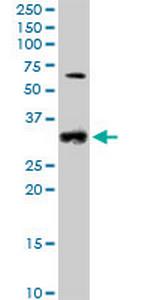 CCND2 Polyclonal Antibody, MaxPab™