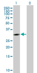 CCNG1 Antibody in Western Blot (WB)