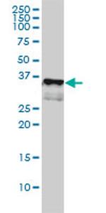 CD1A Antibody in Western Blot (WB)