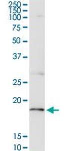 CD247 Antibody in Western Blot (WB)
