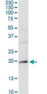 CD247 Antibody in Western Blot (WB)