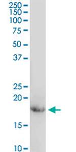 CD247 Antibody in Western Blot (WB)