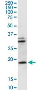 CD247 Antibody in Western Blot (WB)