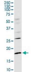 CD247 Antibody in Western Blot (WB)