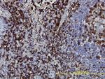 CD3Z Antibody in Immunohistochemistry (Paraffin) (IHC (P))