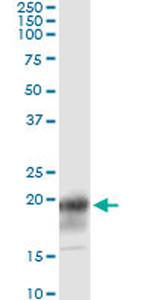 CD3Z Antibody in Immunoprecipitation (IP)