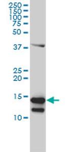 CD3Z Antibody in Western Blot (WB)
