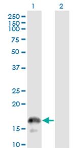 CD3Z Antibody in Western Blot (WB)