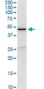 CD5L Antibody in Western Blot (WB)