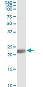 CD8A Antibody in Immunoprecipitation (IP)