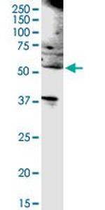 CD19 Antibody in Western Blot (WB)