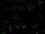 CD19 Antibody in Immunocytochemistry (ICC/IF)