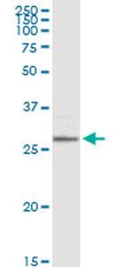 MS4A1 Antibody in Western Blot (WB)
