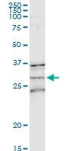 MS4A1 Antibody in Western Blot (WB)