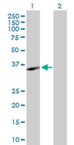 MS4A1 Polyclonal Antibody, MaxPab™