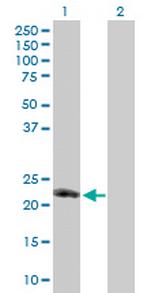 TNFSF8 Polyclonal Antibody, MaxPab™