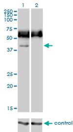 CD33 Monoclonal Antibody (2D12-G4)