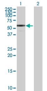 ENTPD3 Polyclonal Antibody, MaxPab™