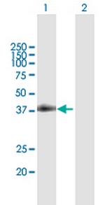 CD40 Antibody in Western Blot (WB)