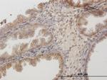 CD44 Antibody in Immunohistochemistry (Paraffin) (IHC (P))