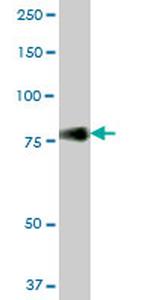 CD44 Antibody in Western Blot (WB)