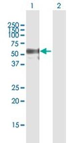 CD44 Antibody in Western Blot (WB)