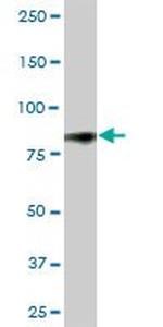 CD44 Antibody in Western Blot (WB)