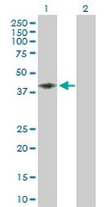 CD58 Antibody in Western Blot (WB)