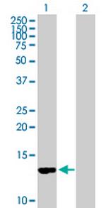 CD59 Antibody in Western Blot (WB)