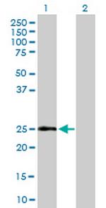 CD69 Antibody in Western Blot (WB)