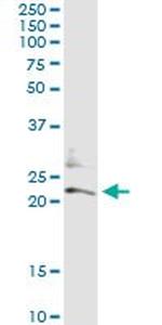 CD74 Antibody in Immunoprecipitation (IP)
