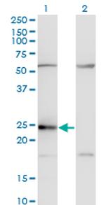 CD74 Antibody in Western Blot (WB)