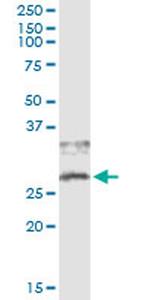 CD79B Antibody in Immunoprecipitation (IP)