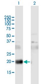 CD81 Antibody in Western Blot (WB)