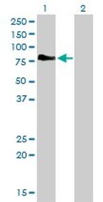 CD97 Antibody in Western Blot (WB)