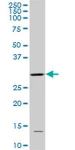 CDC2 Antibody in Western Blot (WB)