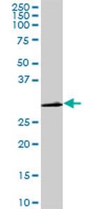 CDC2 Antibody in Western Blot (WB)