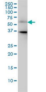 CDC25C Monoclonal Antibody (3B11)
