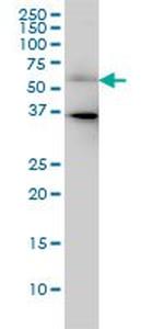 CDC25C Antibody in Western Blot (WB)