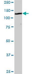 CDH1 Antibody in Western Blot (WB)