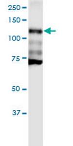 CDH1 Monoclonal Antibody (3F4)
