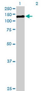 CDH3 Polyclonal Antibody, MaxPab™
