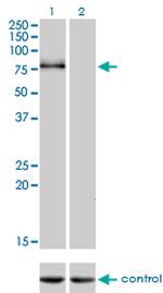CDH6 Monoclonal Antibody (2F2)